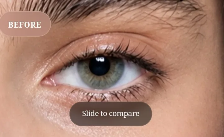 Her eye before the set